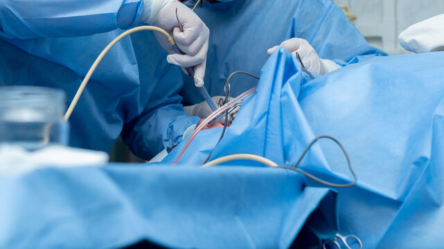 Otolaryngologist performs tonsillectomy, removal of tonsils, ENT. septoplasty, maxillofacial surgery.An array of medical instruments and hoses is visible, indicating a sterile surgical environment. 