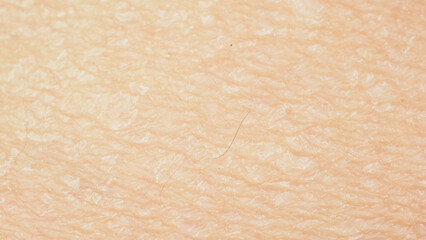 Dry skin.Close up picture