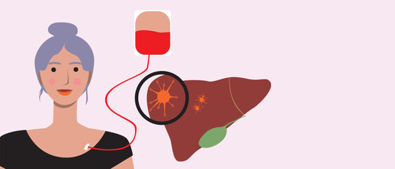 Cancer patients silhouettes and cancer ribbon, silhouette vector stock illustration with unidentifiable people together as a template with space for text or copy space