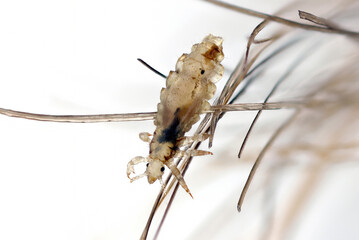 Head louse, Pediculus humanus capitis, on a human hair.