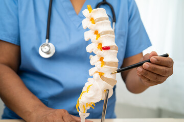 Doctor with lumbar vertebra bone skeleton and nerve model for treatment in the orthopedic...