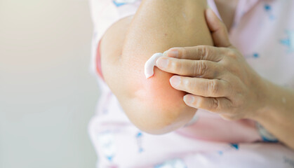 Close up of unrecognizable old woman applying ointment cream for elbow pain at home