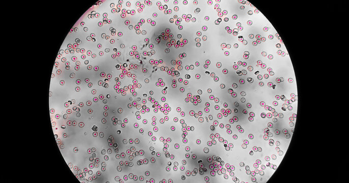Red blood cells (RBC) erythrocytes microscopic image.