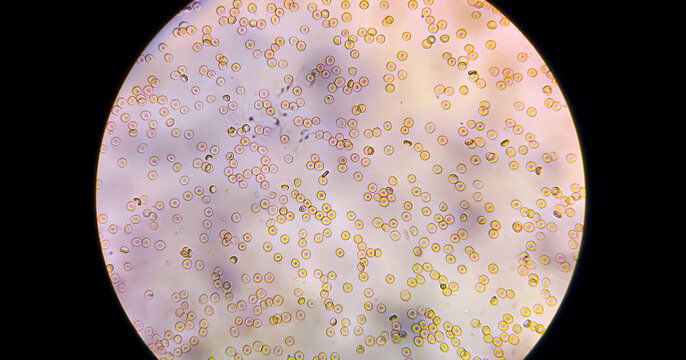 Red blood cells (RBC) erythrocytes microscopic image.