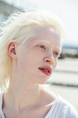A beautiful young woman with albinism, featuring fair skin, white hair, and delicate features. She looks confident and serene, with soft natural lighting highlighting her unique beauty