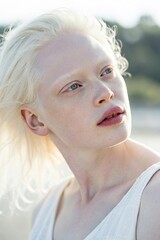 A beautiful young woman with albinism, featuring fair skin, white hair, and delicate features. She looks confident and serene, with soft natural lighting highlighting her unique beauty.
