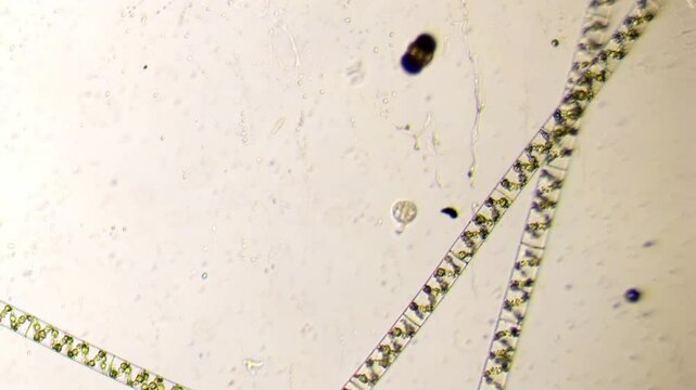 Vorticella retracts, detaches from surface, and swims away