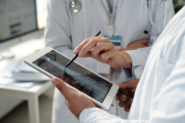 Close up of two unrecognizable doctors analyzing x ray images on tablet screen with hand pointing...