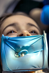 The dentist treats the child's tooth using a rubber dam. Close-up of tooth treatment.