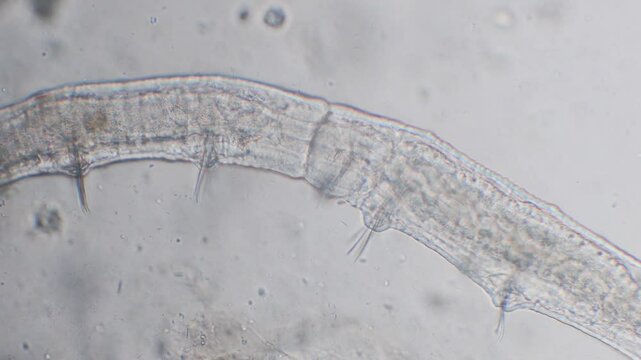  Worm of the family Naididae under the microscope, Naididae,   clitellate,  oligochaete,  worms, TICINO RIVER, Italy , internal stomach, intestine in transparency, microscope