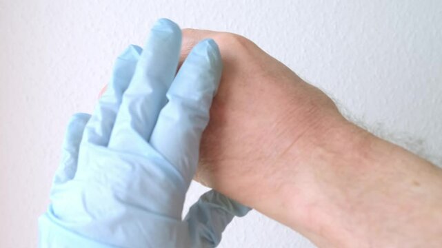 hand elderly man with inflamed tendon from rheumatism, doctor inspecting inflamed dorsal side male hand for symptoms of potential condition, doctor palpating patient's painful palm