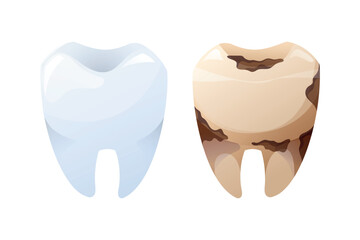 Healthy and decayed tooth comparison, detailed vector cartoon illustration. Dental health and oral hygiene concept, isolated on white background.
