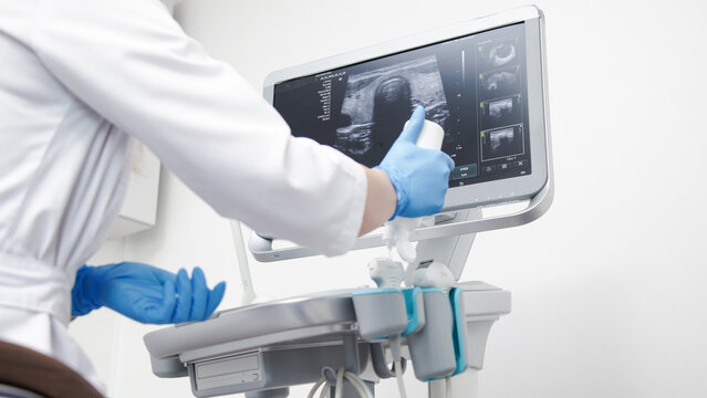 Close-up of ultrasound equipment with a probe in a modern diagnostic center. The concept of precision and advanced technology in professional medicine.