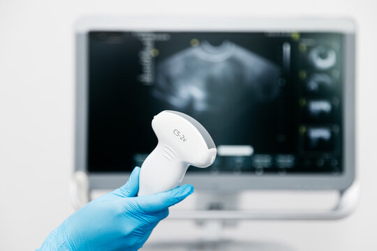 An ultrasound probe in the hands of a medical professional during preparation for examination. The concept of modern technology and precision in diagnostic medicine.