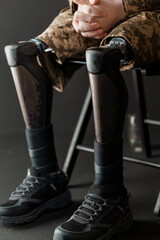 A Close-Up of a Soldier Wearing Advanced Bionic Leg Prosthesis