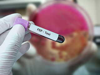 Obraz premium Biochemist or Scientist holds blood sample for FEP (Free erythrocyte protoporphyrin) test. Medical test tube in laboratory background.