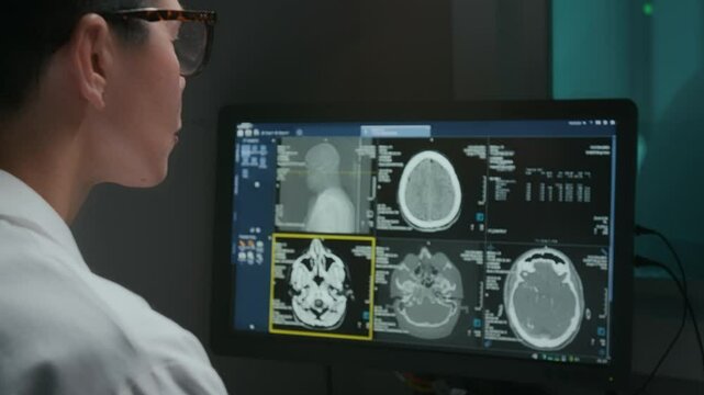Over-shoulder shot of female radiology diagnostician in white coat examining brain PET scan on computer screen, searching for symptoms while diagnosing injury or degenerative disease