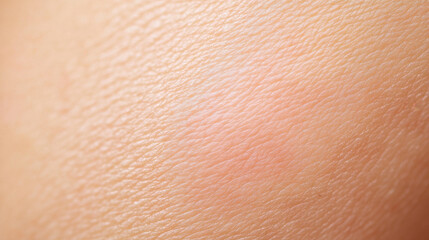 Fototapeta premium Macro of person skin showing texture and faint mark, possibly from insect bite, highlighting details of human skin