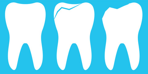 Illustration of Healthy, Chipped, and Fractured Teeth on Blue Background