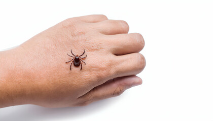 Obraz premium macro close-up of a brown tick on human hand, detailed view of parasite insect on skin, vector for disease transmission on isolated white background 