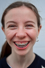 Fototapeta premium Close-up of a cheerful teenager girl showing her braces and smiling on a white background