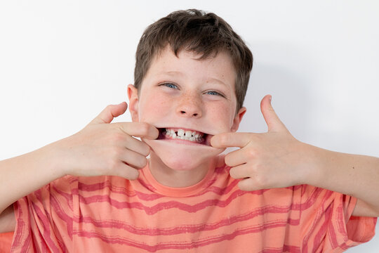 Young boy shows off his milk teeth falling out