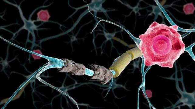 Biomedical animation showing multiple sclerosis healed by a T-cell.