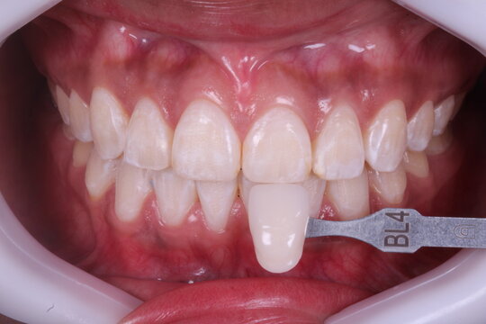 Dentista