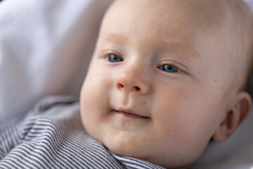 Smiling newborn baby with red pimples on the face and pink eye. Closeup.