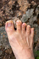 Photos of feet on stone