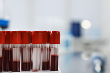 Tubes with blood samples in laboratory, closeup. Space for text