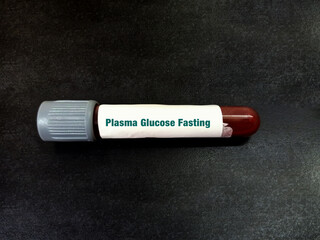 Blood sample of Plasma glucose Fasting (FGP) test. Fasting blood sugar(FBS) for Diabetes Mellitus patient.