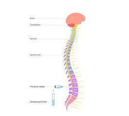 Lumbar puncture spinal tap