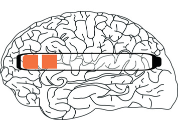 The image shows a black and white illustration of a brain with a horizontal progress bar partially filled in orange.