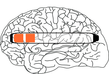 The image shows a black and white illustration of a brain with a horizontal progress bar partially filled in orange.