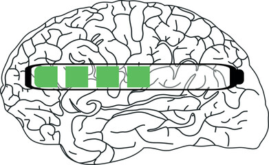 The image shows a black and white illustration of the brain with a horizontal progress bar partially filled with green.
