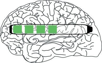 The image shows a black and white illustration of the brain with a horizontal progress bar partially filled with green.