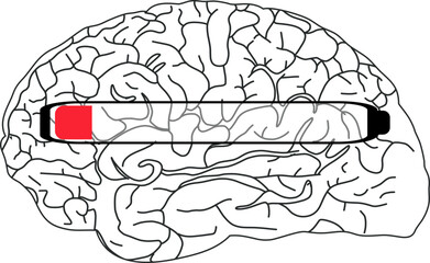The image shows a black and white illustration of a brain with a horizontal progress bar partially filled in red.