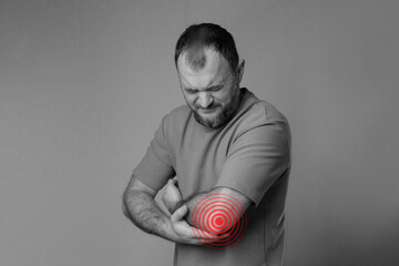 man experiencing elbow pain due to joint problems, arthritis, bursitis or epicondylitis tennis...