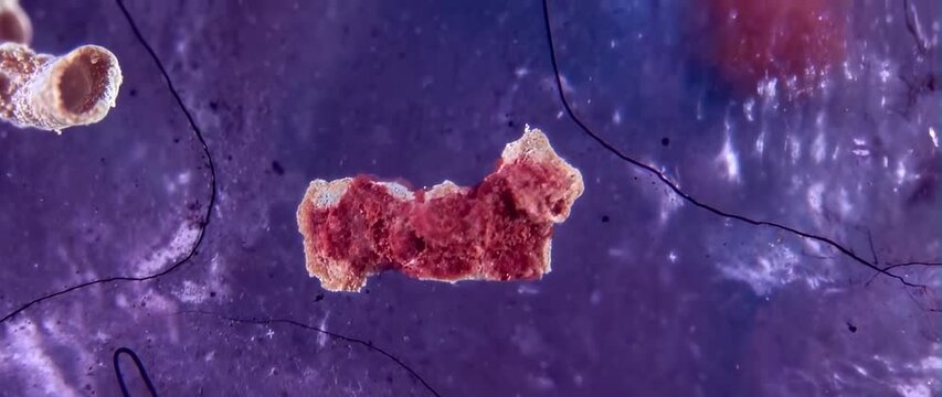 Anamorphic video animation of a cancer cell, medical and science concept 