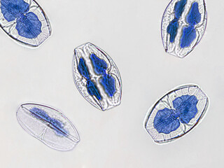 Probiotics, lactic acid bacteria. Algae, bacteria and microorganisms. Microscopic probiotics,...