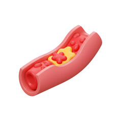 Blocked Blood Vessel Icon, Clogged Artery Illustration, Blood Flow Issue Graphic, Cardiovascular Health Visual, Medical Circulatory System Concept