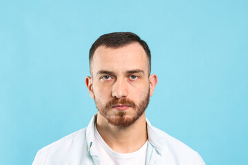Fototapeta premium Baldness problem. Man with receding hairline on light blue background