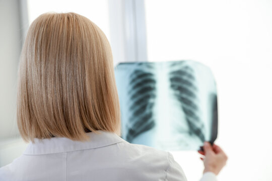 Doctor examining chest x-ray near window in clinic, back view