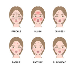 Cosmetic skin trouble_woman with freckle, blush, dryness, papule, pastule, blackhead