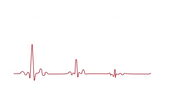 Heart failure, cardiac arrest, wave attenuation chart self drawing animation. Animated red line on white background.