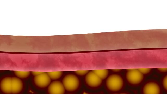 An animated cross-section of human skin showing the gradual reduction of subcutaneous fat after taking supplements or treatments. The video highlights weight loss, dermatology, and medical science. Id