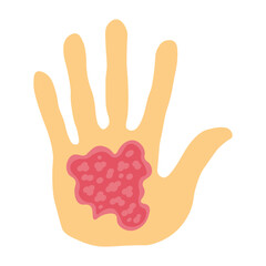 Fototapeta premium Eczema