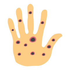 Monkeypox virus on skin 