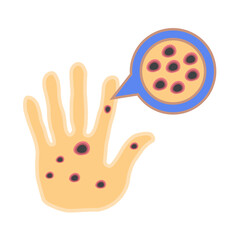 Monkeypox virus on skin 